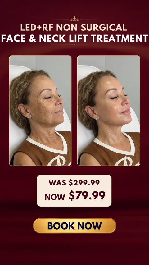 Med spa ad creative for an LED and RF non surgical face and neck lift offer