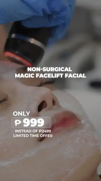 Ad creative featuring a lip filler before and after transformation