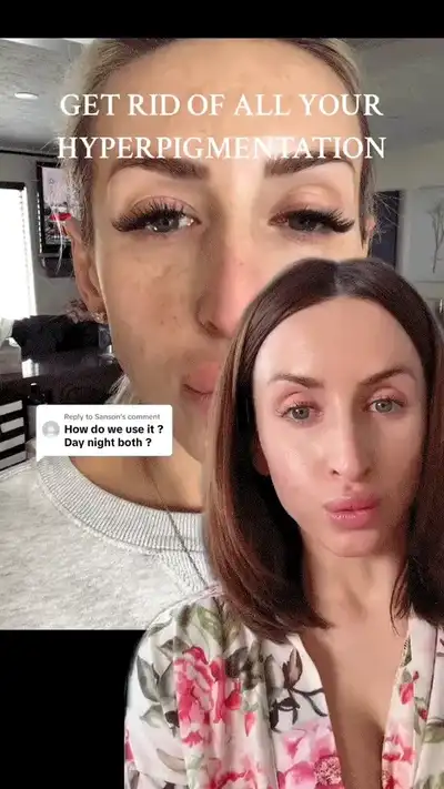 Ad creative showing laser hair removal results on smooth skin
